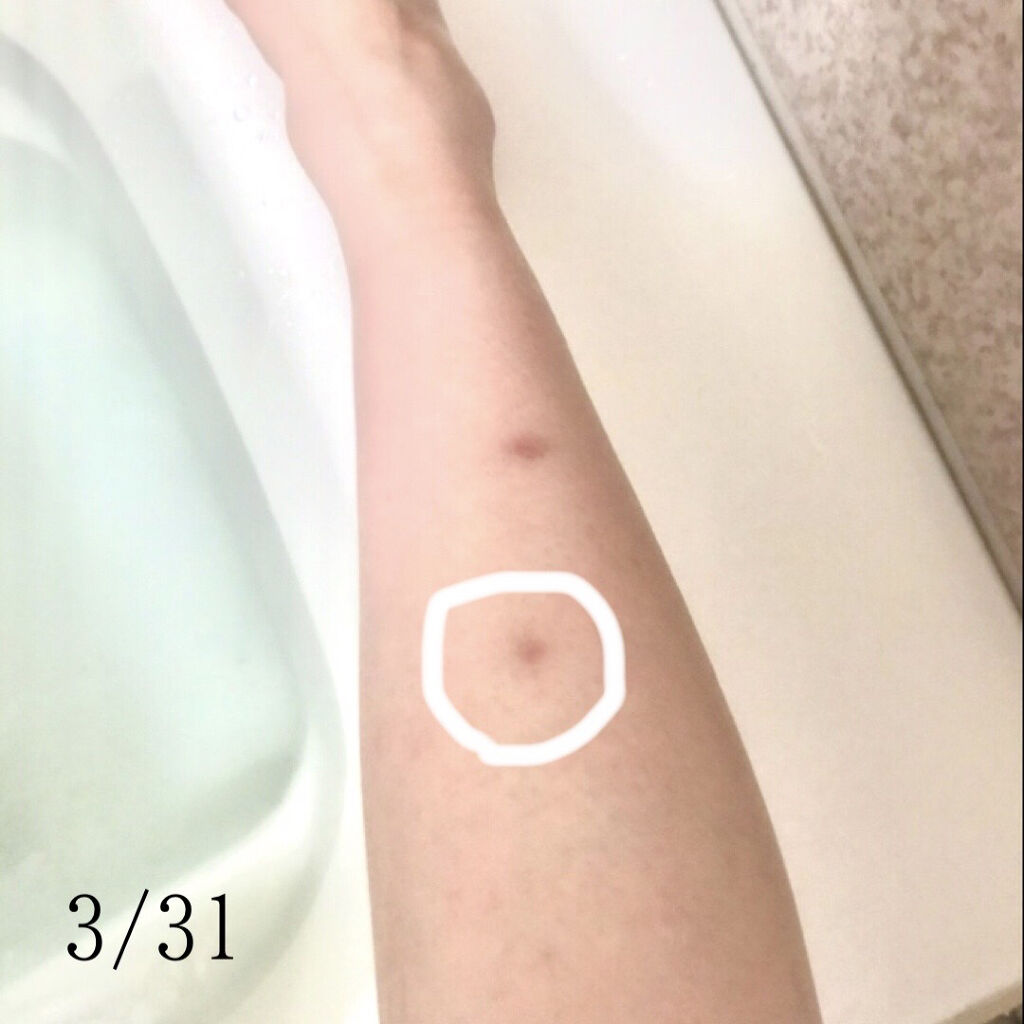 100LAAインパウダー/The Ordinary/その他スキンケアを使ったクチコミ（2枚目）