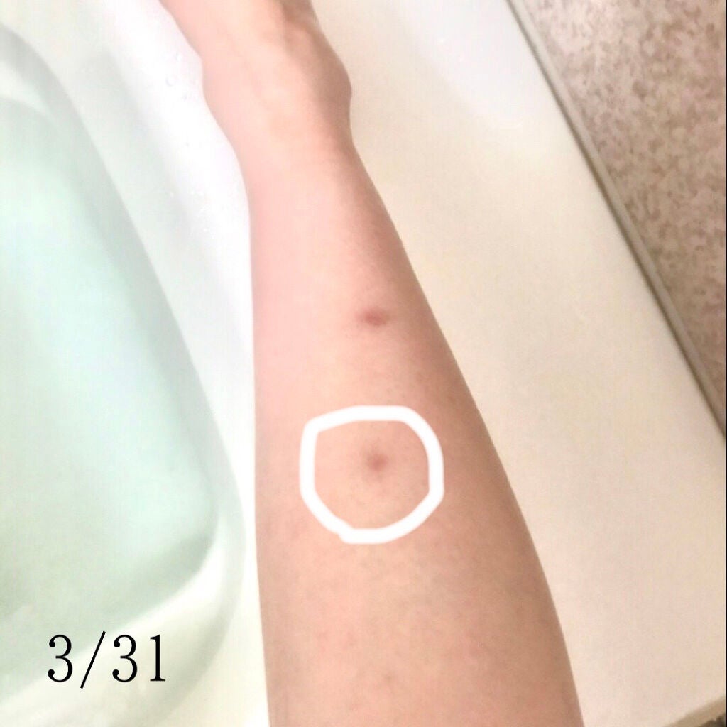 LA10+HAフェイスセラム/The Ordinary/ピーリングを使ったクチコミ(2枚目)