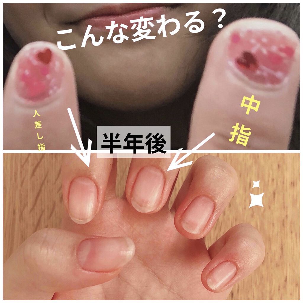 エテュセ クイックケアコート/ettusais/ネイルオイル・トリートメントを使ったクチコミ（1枚目）