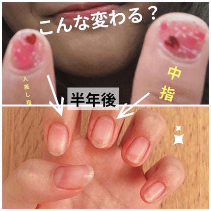キューティクルオイル/ネイルホリック/ネイルオイル・トリートメントを使ったクチコミ(1枚目)