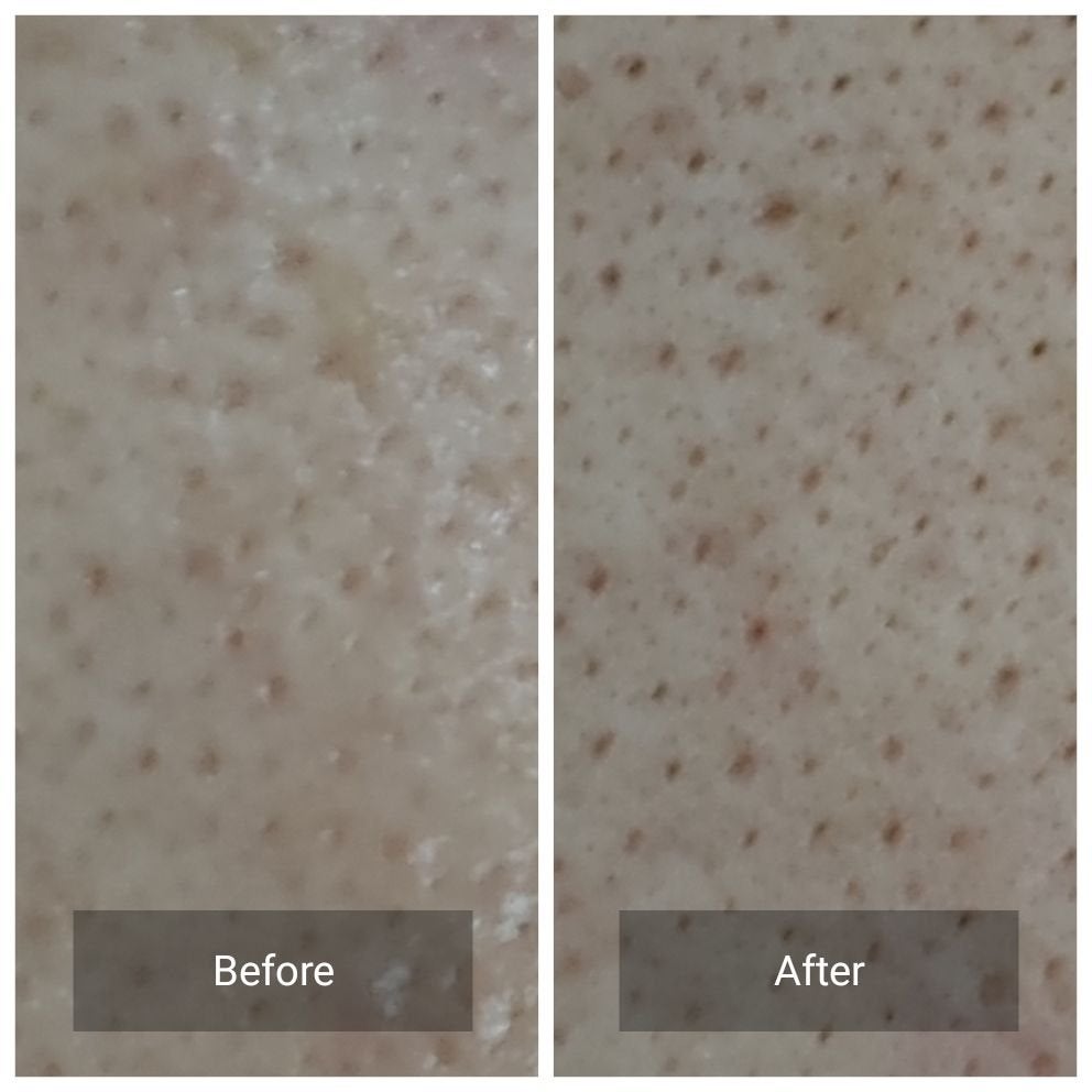 ソフィーナ iP ハリ弾力注入美容液/SOFINA iP/美容液を使ったクチコミ(6枚目)