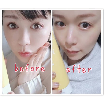 あたりちゃん♥️フォロバ&イイネ返し on LIPS 「メイク&毛穴汚れを溶かしてイッキ落ち😲✨❓❓モッチスキン吸着ク..」(9枚目)