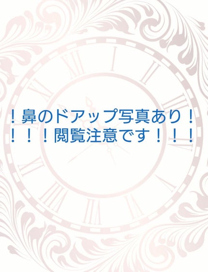 ソフティモ 薬用ホワイト クレンジングウォッシュ/ソフティモ/洗顔フォームを使ったクチコミ(1枚目)