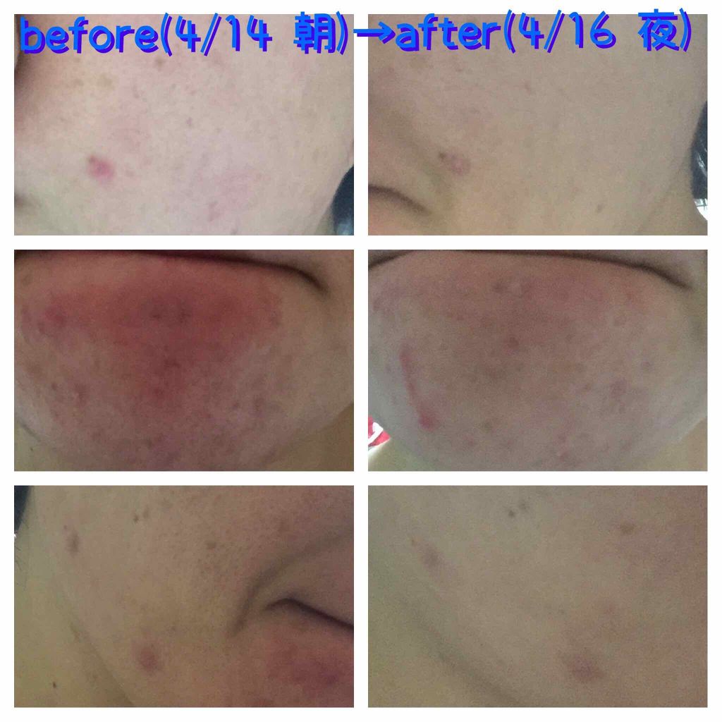 スペシャルジェルクリーム(モイスト)/アクアレーベル/オールインワン化粧品を使ったクチコミ(2枚目)