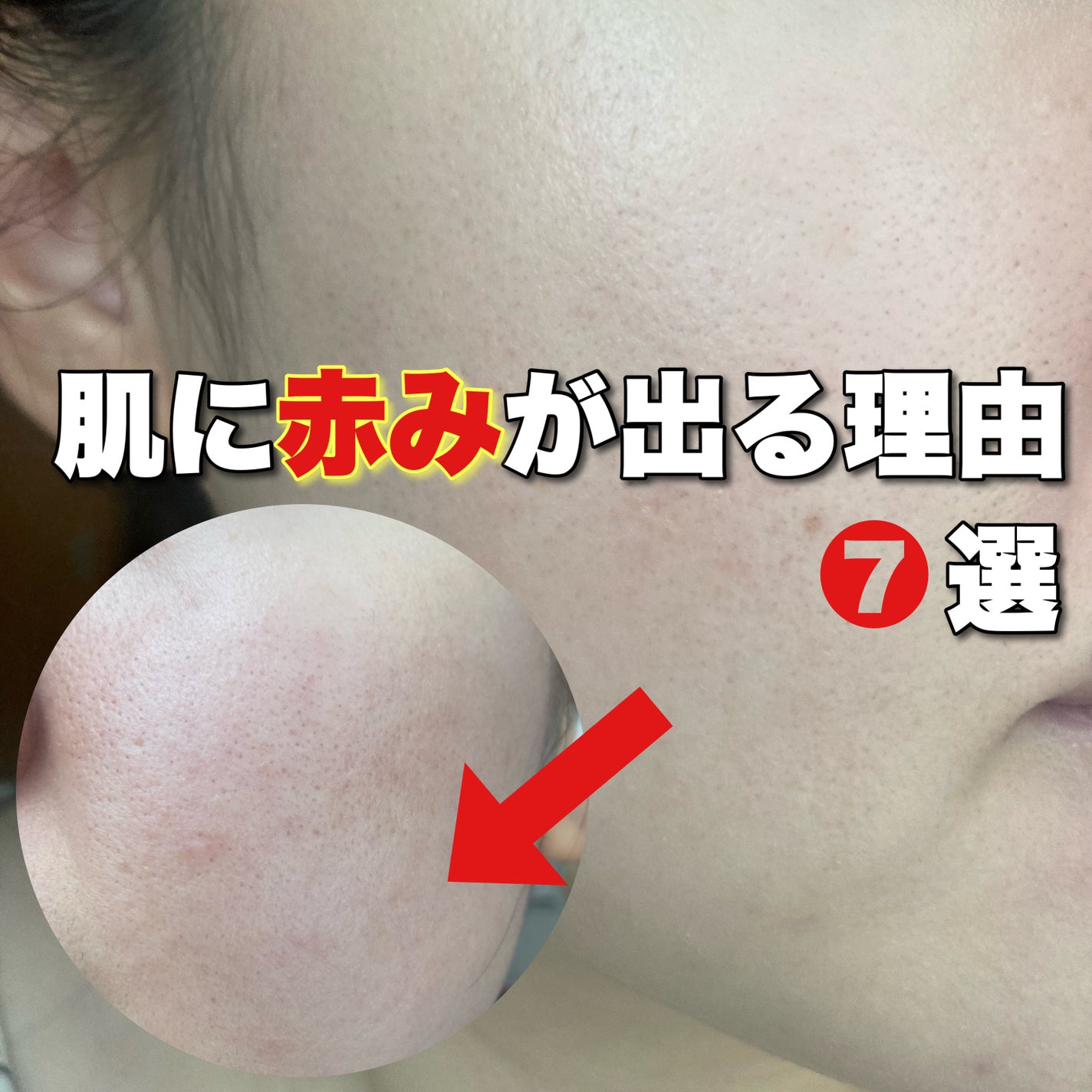 潤浸保湿 フェイスクリーム/キュレル/フェイスクリームを使ったクチコミ(1枚目)