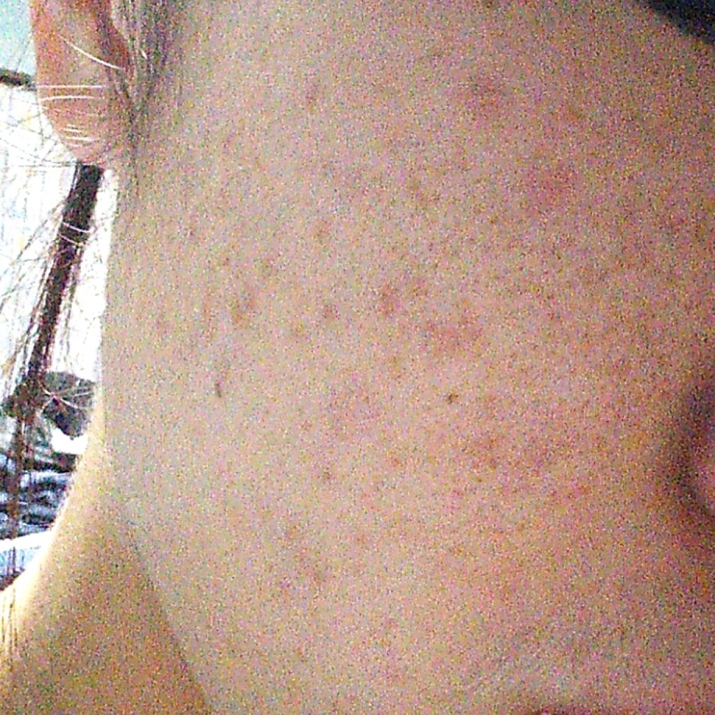 DHC ビタミンCハードカプセル/DHC/美容サプリメントを使ったクチコミ(3枚目)