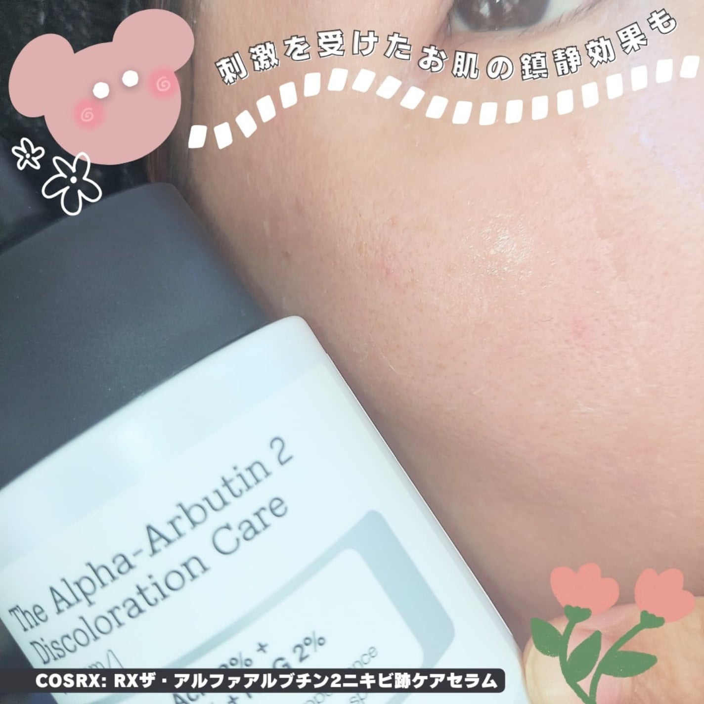 RXザ・アルファアルブチン2 ニキビ跡ケアセラム/COSRX/美容液を使ったクチコミ(4枚目)