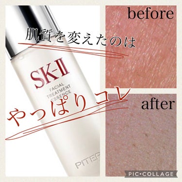 フェイシャル トリートメント エッセンス/SK-II/化粧水を使ったクチコミ（1枚目）