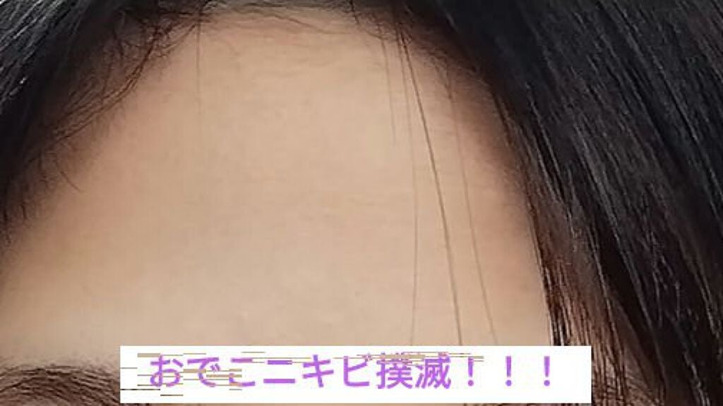 薬用スキンミルク/オードムーゲ/乳液を使ったクチコミ(1枚目)