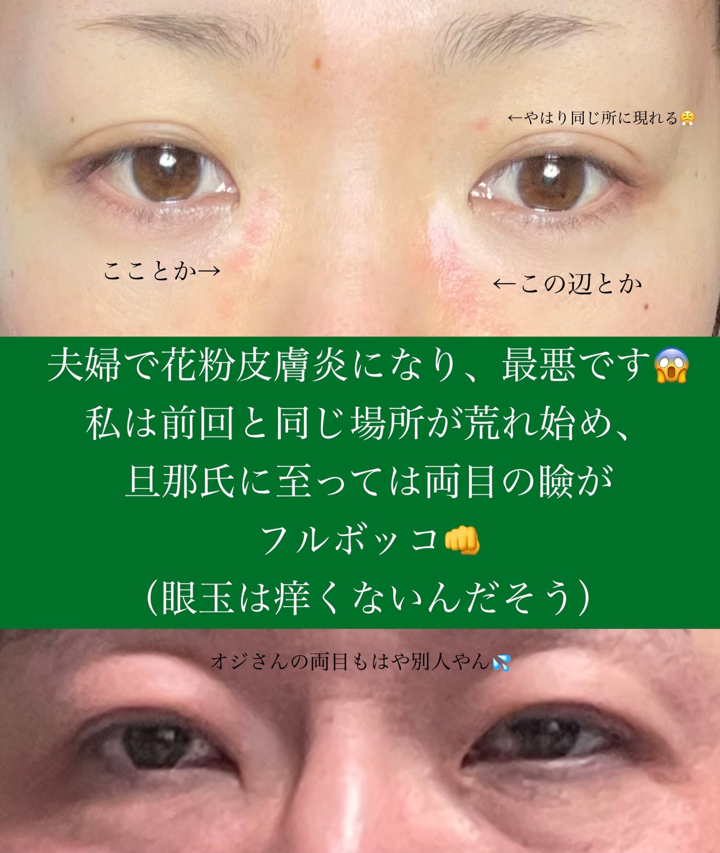 アレルスクリーン/IHADA/その他スキンケアを使ったクチコミ(2枚目)