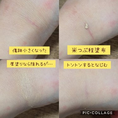 アットノン コンシーラータイプ(医薬品)/アットノン/その他を使ったクチコミ（2枚目）