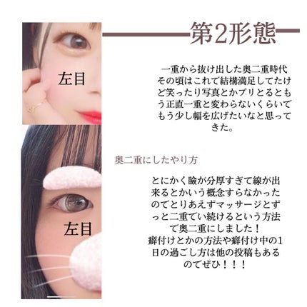 オリシキ アイリッドスキンフィルム		/D-UP/二重まぶた用アイテムを使ったクチコミ(3枚目)