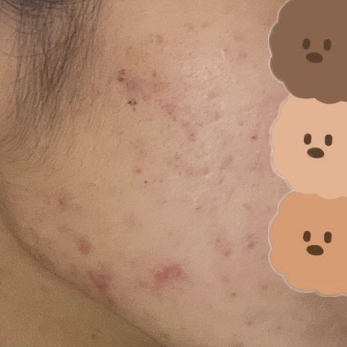 ガラクナイアシン2.0エッセンス/manyo/美容液を使ったクチコミ(6枚目)