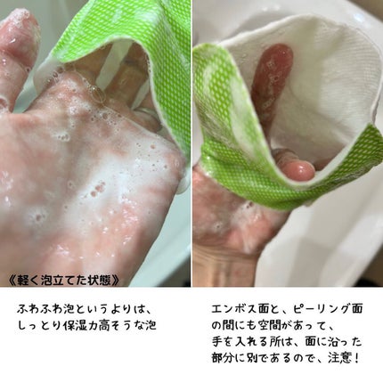 ボディピーリングパッド/Mom’s Bath Recipe/ピーリングを使ったクチコミ(5枚目)