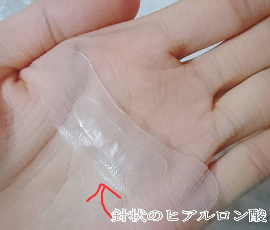 ナチュラベーレ THEマイクロニードル/ナチュラベーレ/シートマスク・パックを使ったクチコミ(6枚目)