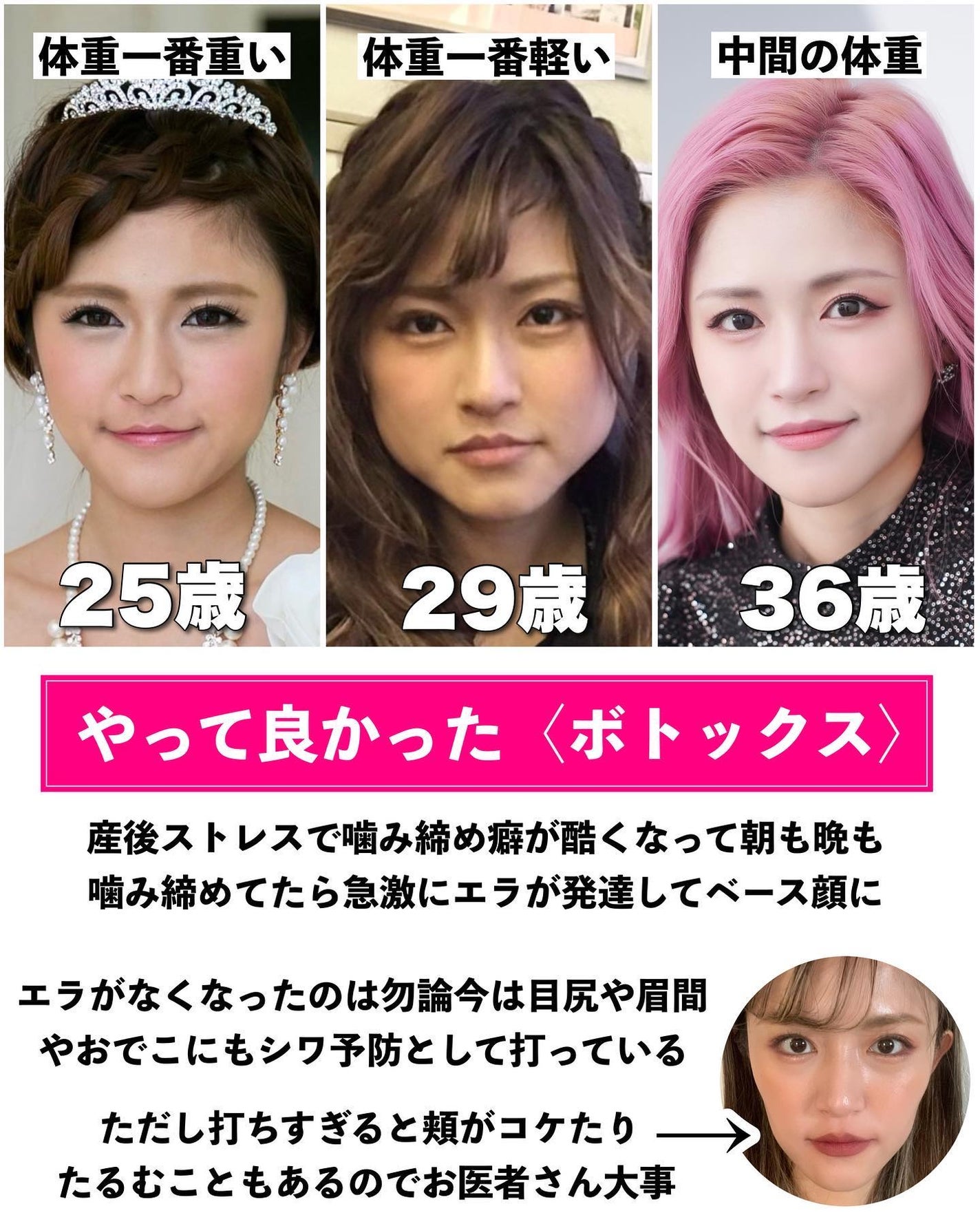 とみりー on LIPS 「36歳がやってよかった美容医療まとめ✨◆───--- - -..」(3枚目)