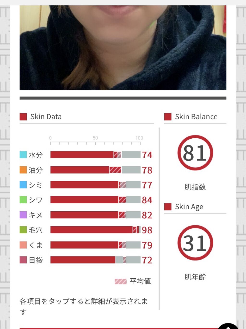 アクアコラーゲンゲルエンリッチリフトEX/ドクターシーラボⓇ/オールインワン化粧品を使ったクチコミ（1枚目）