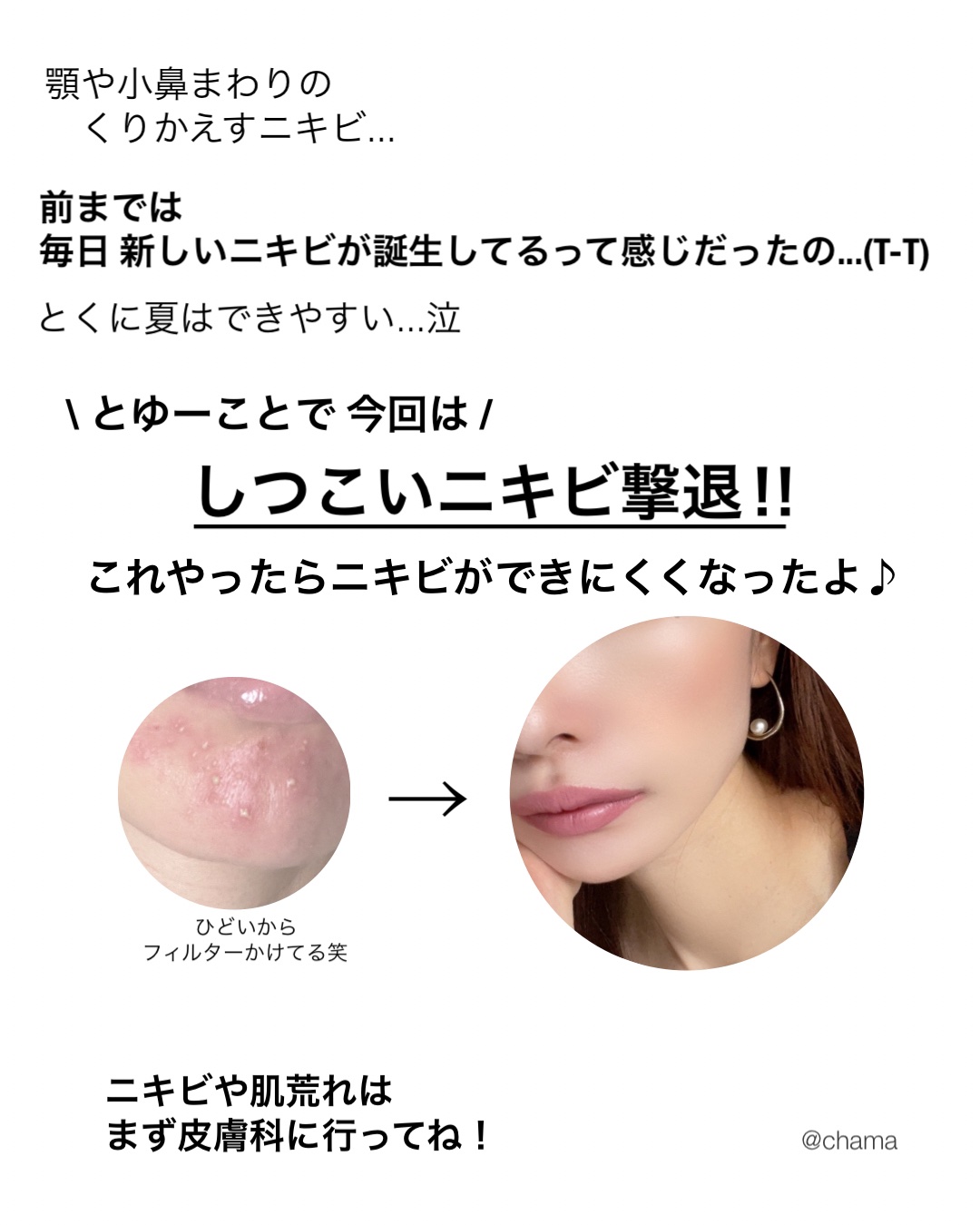 ジョンソン ベビーオイル 無香料/ジョンソンベビー/ボディオイルを使ったクチコミ（2枚目）