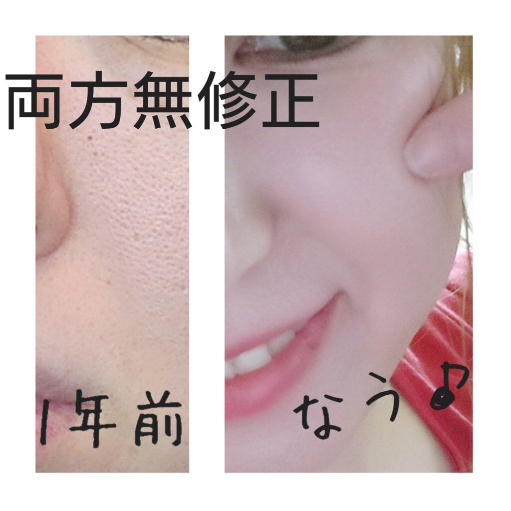 CARBOXYカーボキシー炭酸パック/CARBOXY/シートマスク・パックを使ったクチコミ（2枚目）