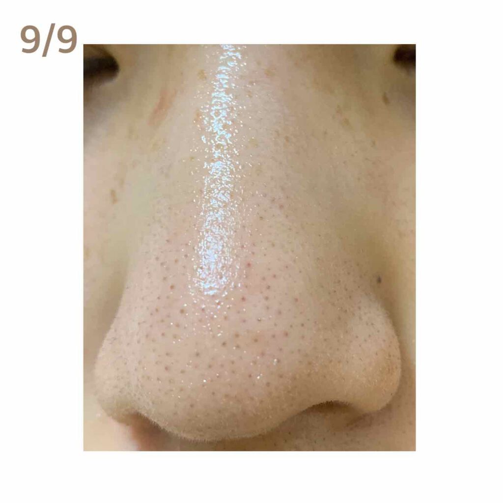 ジョンソンベビーオイル微香性/ジョンソンベビー/ボディオイルを使ったクチコミ(2枚目)