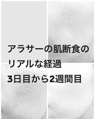 ニャキ:欲しいものが高すぎる on LIPS 「⚠️２枚目に無加工のリアルな肌の画像あります！⚠️肌断食が2週..」（1枚目）