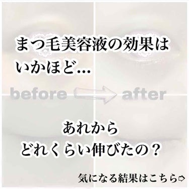 はいどうもー！ゆったり投稿ちーず丸です。


出すとか言っといて出していなかった
エマーキットまつ毛美容液の伸びるか検証結果。

本来なら2.3ヶ月で使い切るものですが
私は、一時期使用しなかったり、サ