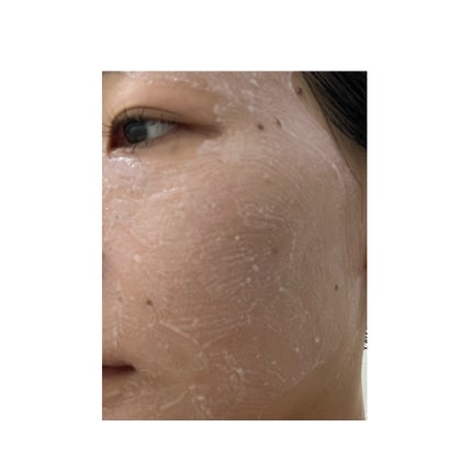 ピンクティーツリーライスシカウォッシュオフパック/APLIN/洗い流すパック・マスクを使ったクチコミ(3枚目)