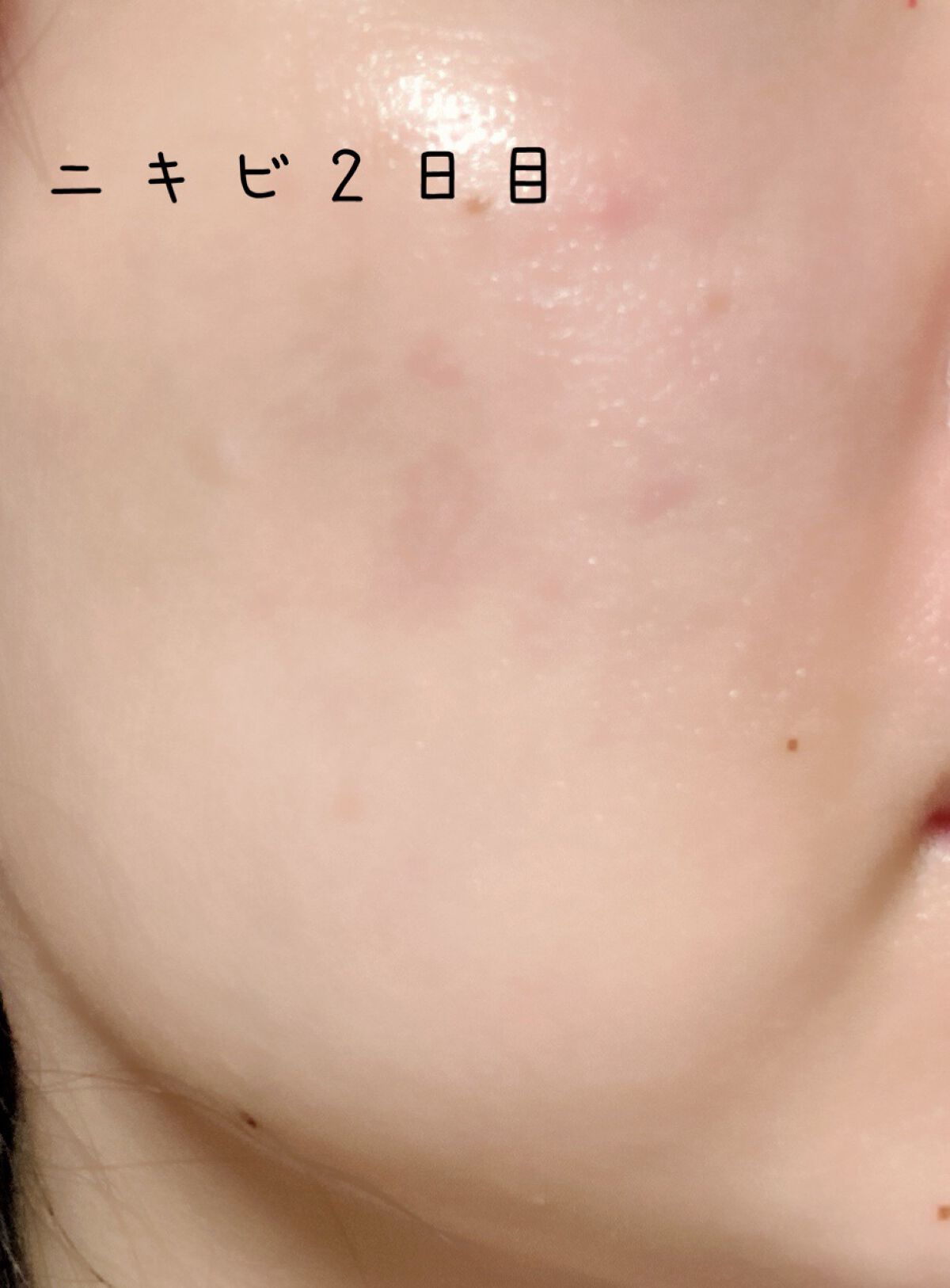 モイスチュア&バランシング セラム/N organic/乳液を使ったクチコミ(1枚目)