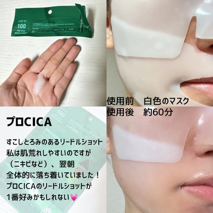 PDRN ハイドロゲルマスク/VT/シートマスク・パックを使ったクチコミ(4枚目)