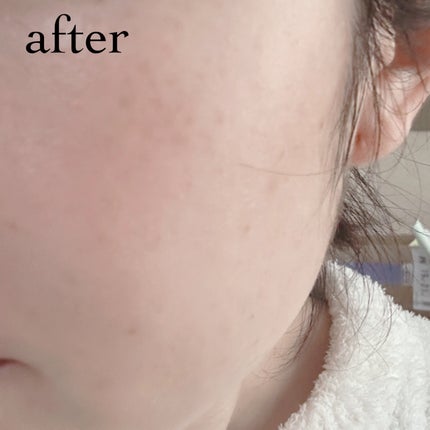 グリーンカーミングセラムミスト/Free Moment /ミスト状化粧水を使ったクチコミ(6枚目)