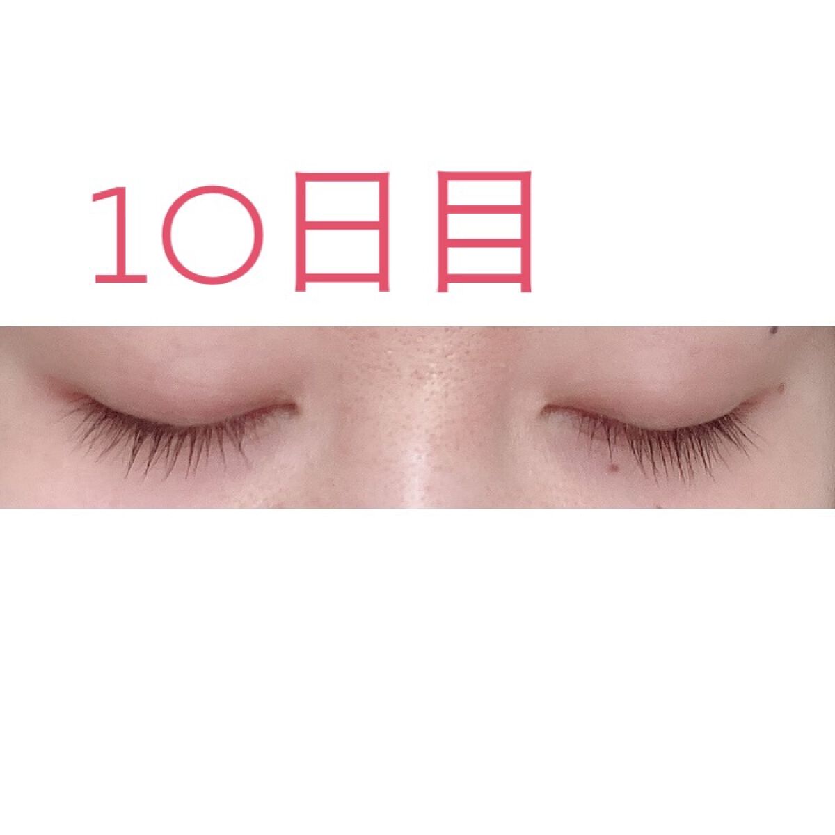ラッシュアディクト✨
10日目
正直あまり変わった様子はないです…
ただ、鏡で良く見るとまつ毛の少し上から柔い毛が生えてきました。
まつ毛の間間から生えてきて欲しい🙄