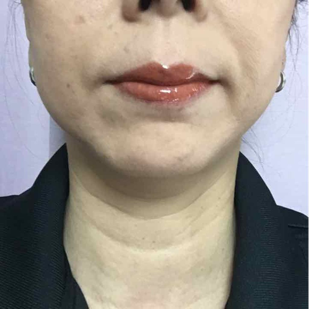 エンスロール グロス/Celvoke/リップグロスを使ったクチコミ（1枚目）