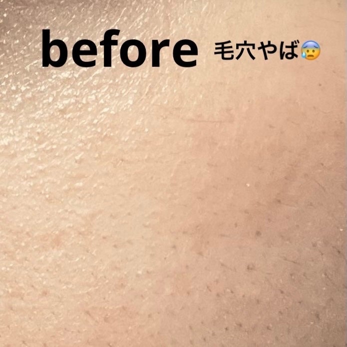 THE シカ 365 バランシングマスク/MEDIHEAL/シートマスク・パックを使ったクチコミ(4枚目)