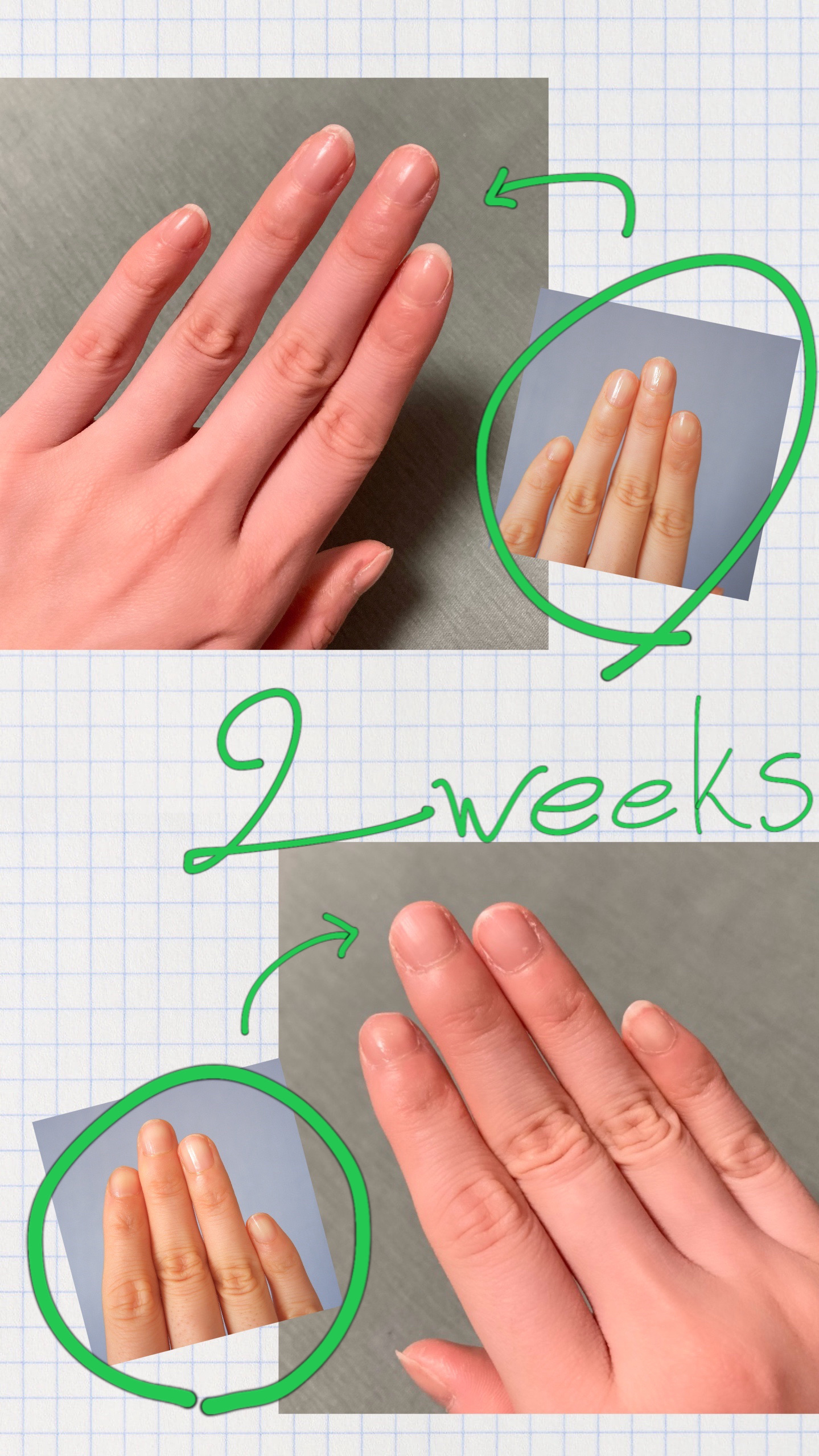 エテュセ クイックケアコート/ettusais/ネイルオイル・トリートメントを使ったクチコミ（1枚目）