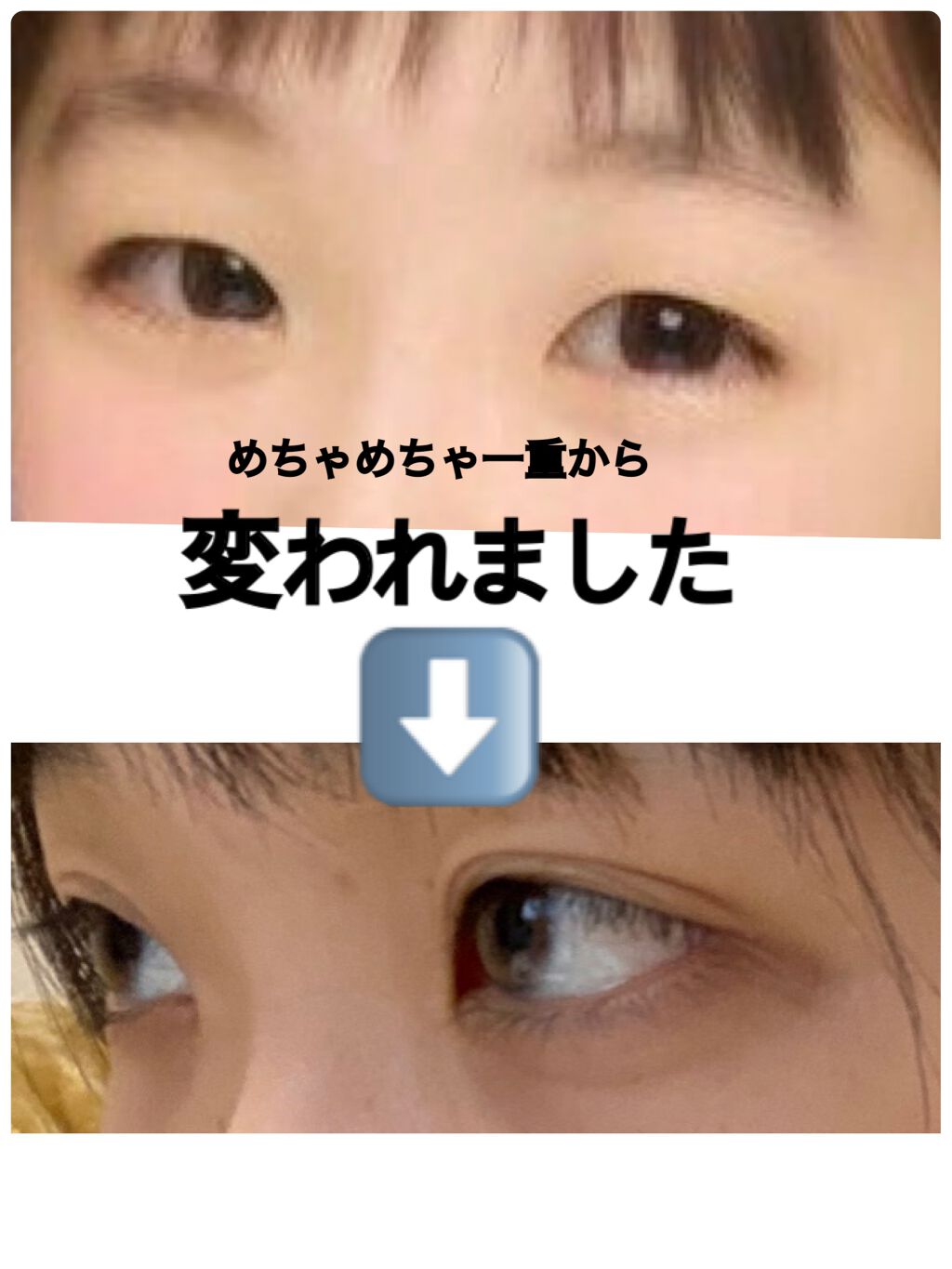 のびーるアイテープ（絆創膏タイプ、レギュラー）/DAISO/二重まぶた用アイテムを使ったクチコミ（1枚目）