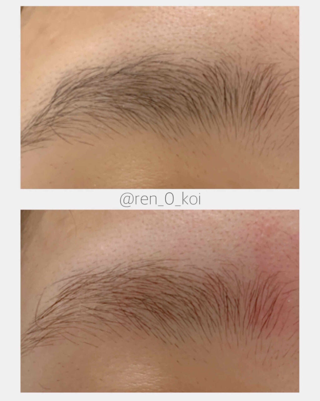 脱色クリーム 敏感肌用/エピラット/ムダ毛ケアを使ったクチコミ(2枚目)