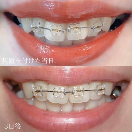 を使ったクチコミ(3枚目)