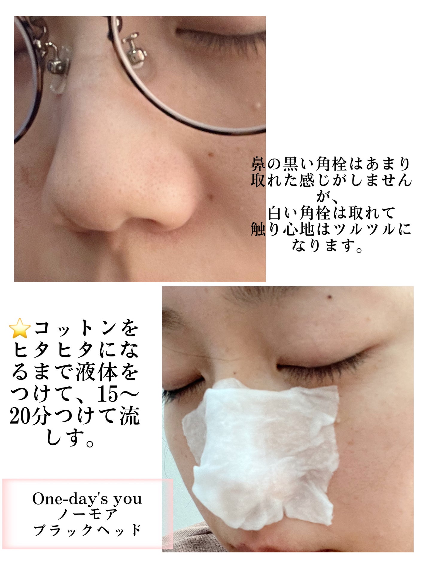 ノーモアブラックヘッド(ノーズピーリング)/One-day's you/スクラブ・ゴマージュを使ったクチコミ(2枚目)