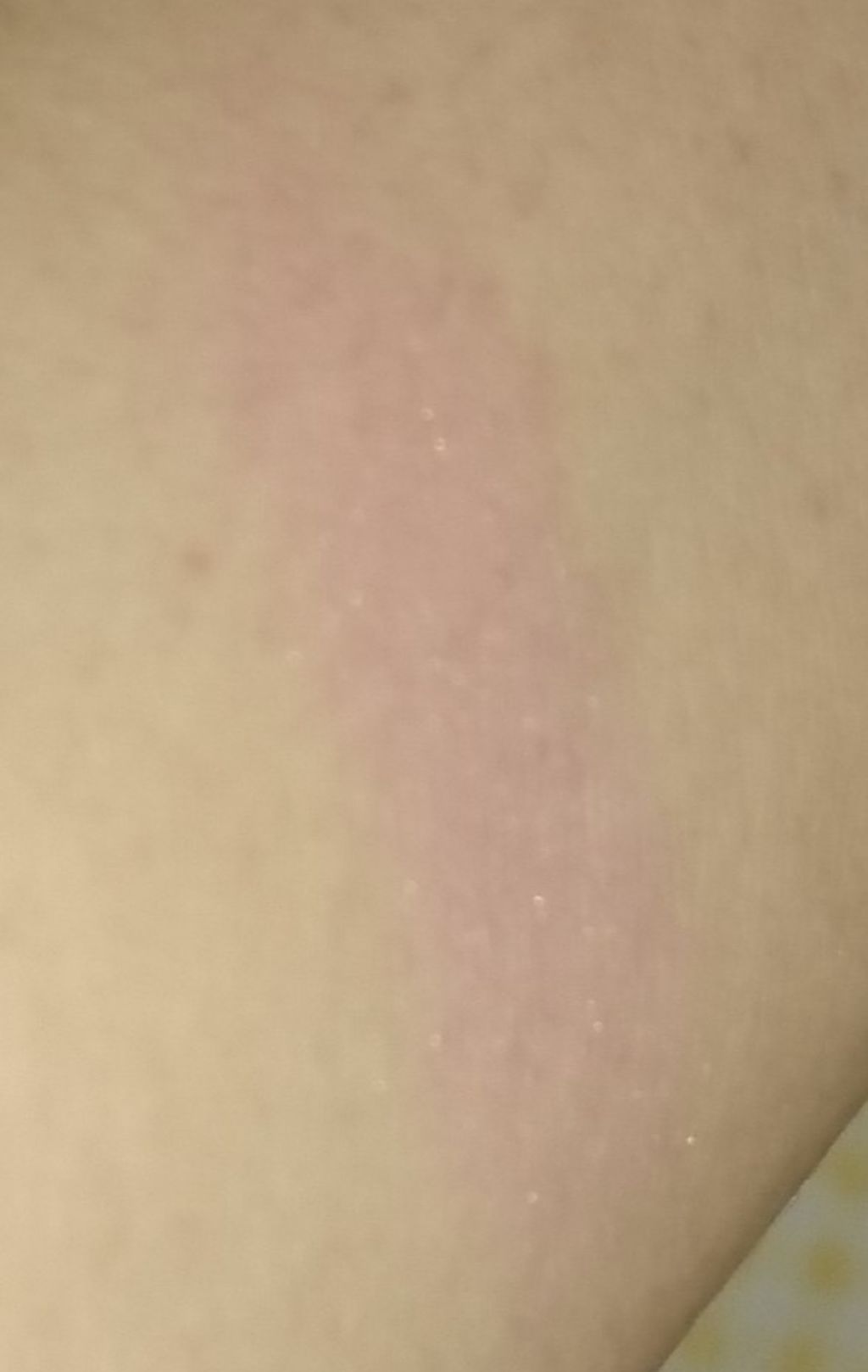 チーク ポップ/CLINIQUE/パウダーチークを使ったクチコミ(3枚目)