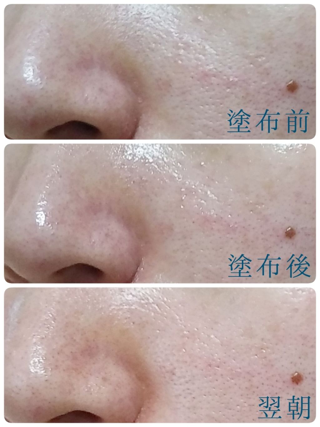 極潤 美白パーフェクトゲル/肌ラボ/オールインワン化粧品を使ったクチコミ(2枚目)