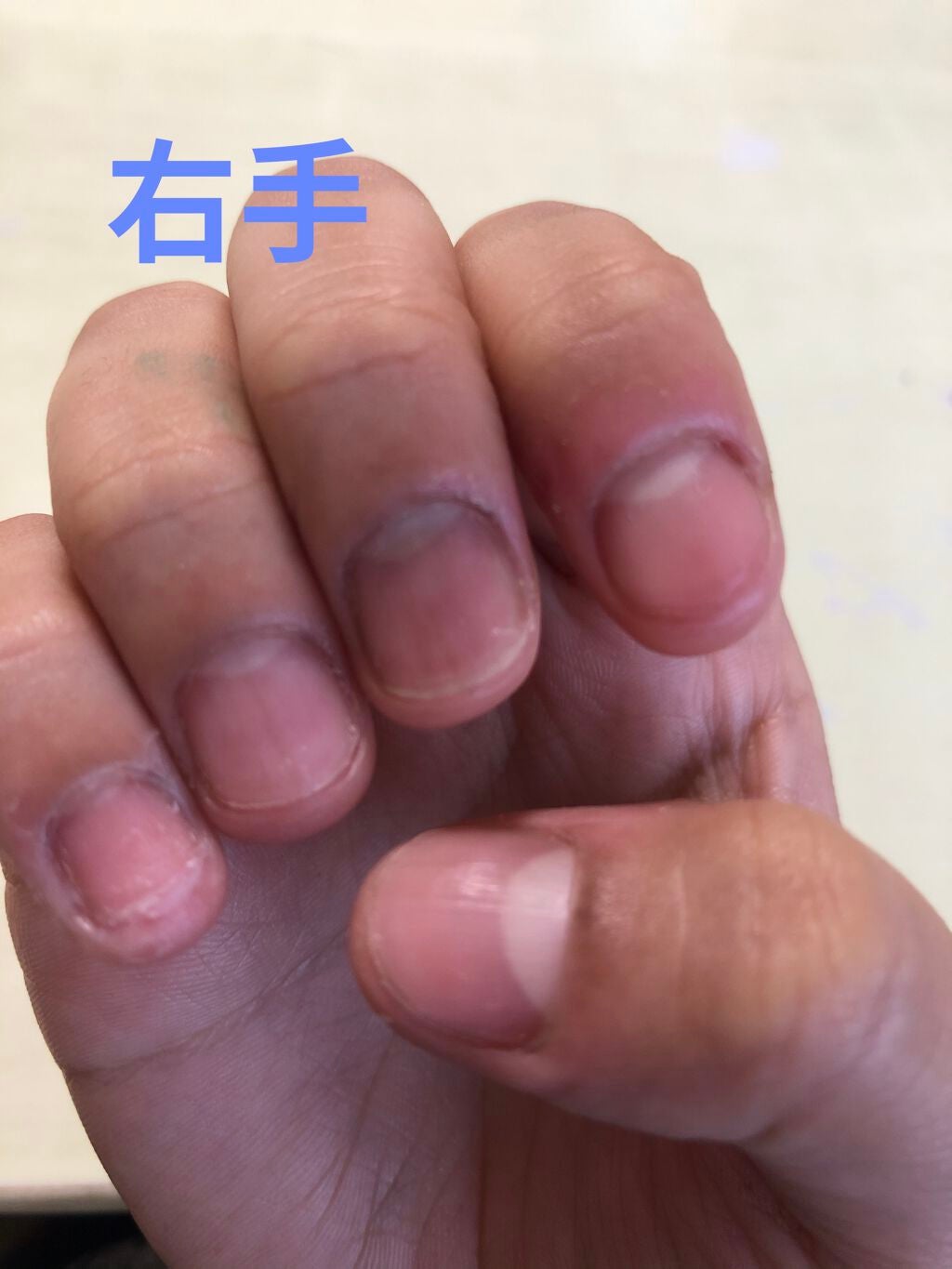 orange_blush_smah on LIPS 「爪育成日記始めます!私は写真にもある通り結構な深爪です。ずっと..」(2枚目)