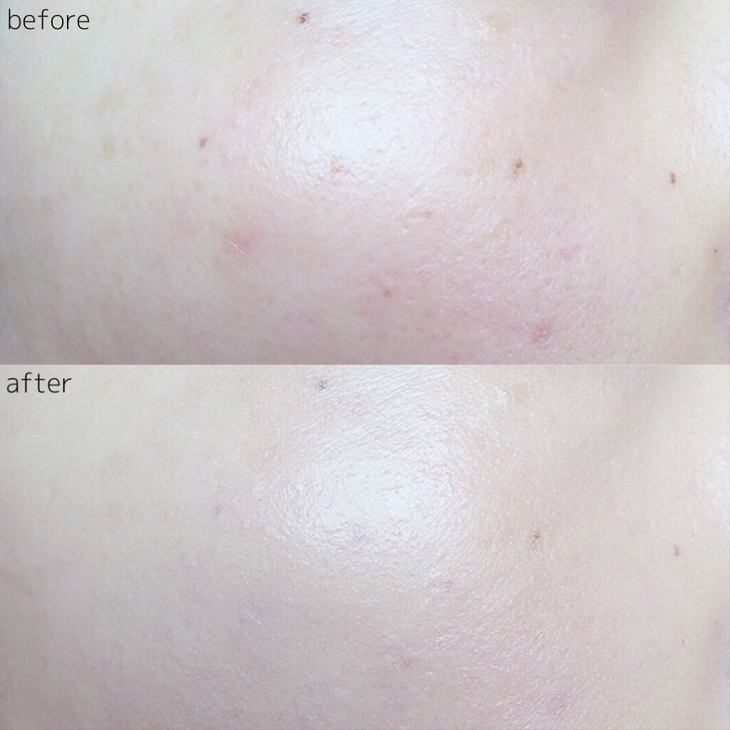 パーフェクティング クッション/エアリ/Sulwhasoo/クッションファンデーションを使ったクチコミ(9枚目)