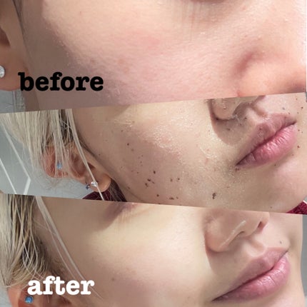 角質スッキリ毛穴パック /HANYUL(ハンユル)/洗い流すパック・マスクを使ったクチコミ(3枚目)