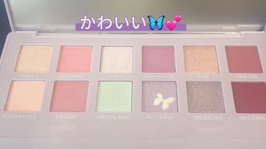 SCANDI(スカンディ)/OLENS/カラーコンタクトレンズを使ったクチコミ（2枚目）