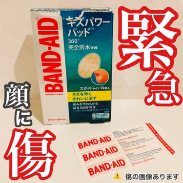 トラブルで顔に傷が出来てしまい、
キズパワーパッドで応急処置をしました😢


そこそこ深く抉れていて
このままでは痕が残ってしまいそうです…⤵︎⤵︎

かなりショックですが、
起きてしまったことはどうし