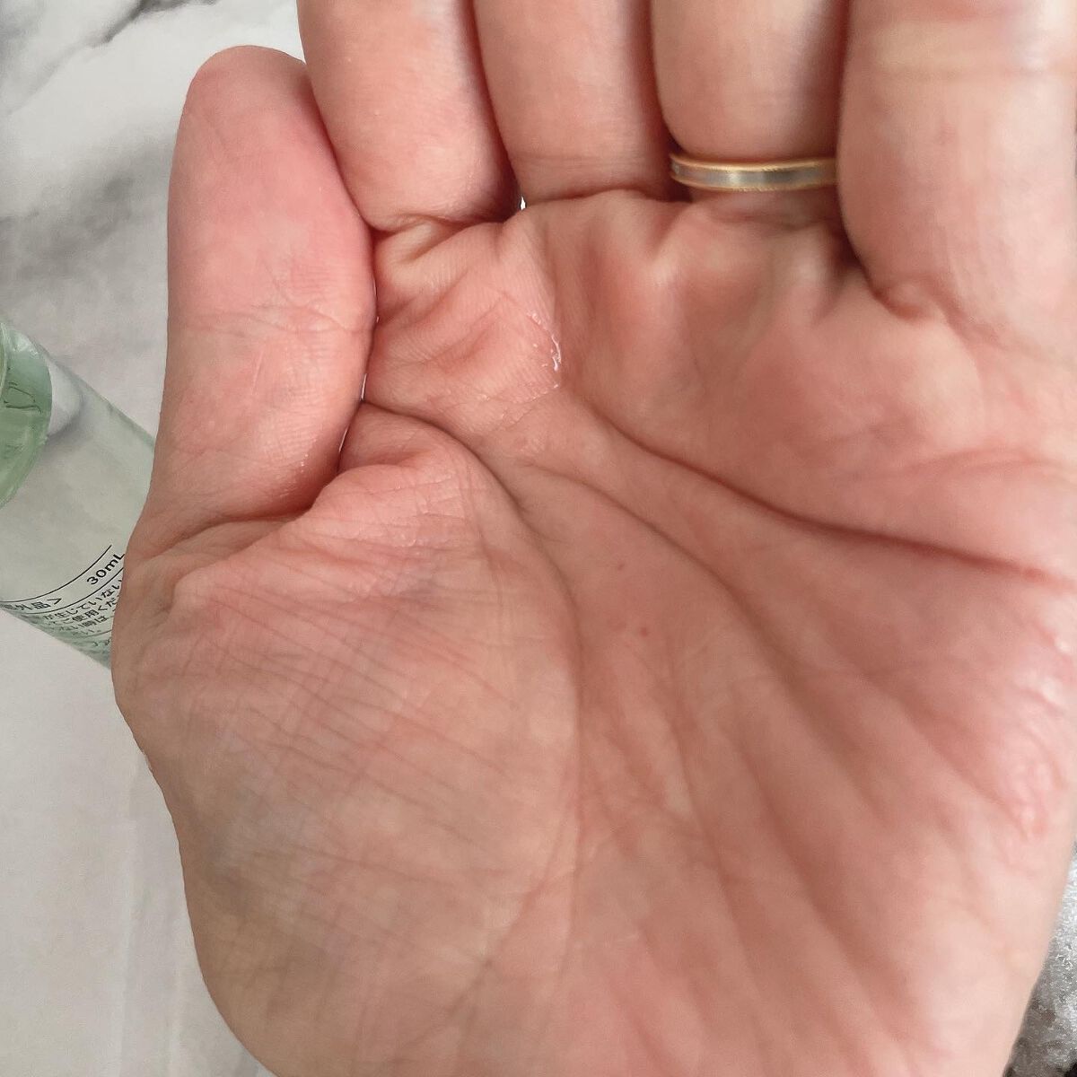 アクネケア ジェル乳液　＜医薬部外品＞/ファンケル/乳液を使ったクチコミ（2枚目）