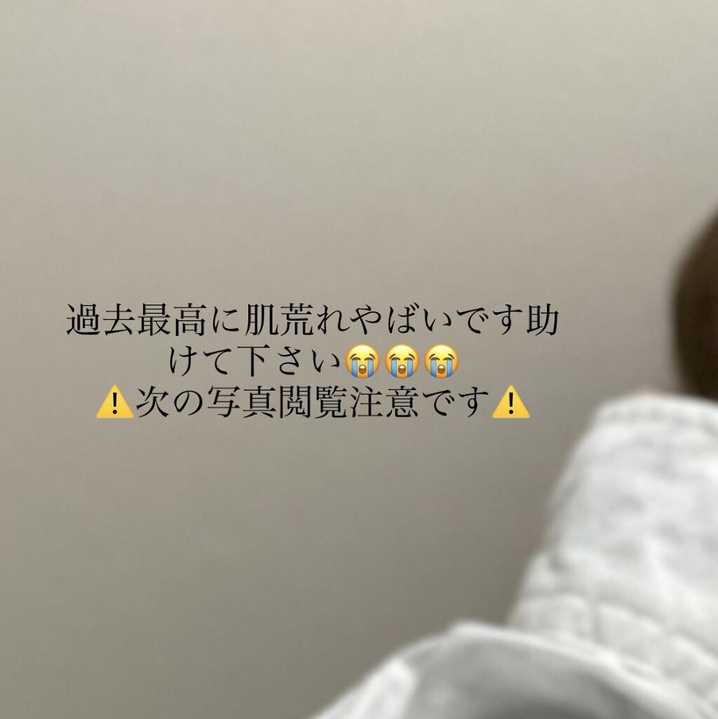 潤浸保湿 泡洗顔料/キュレル/泡洗顔を使ったクチコミ（1枚目）