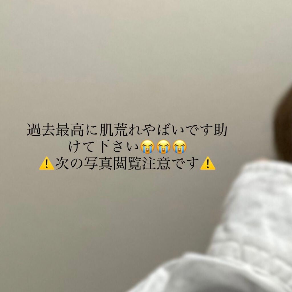 潤浸保湿 泡洗顔料/キュレル/泡洗顔を使ったクチコミ(1枚目)