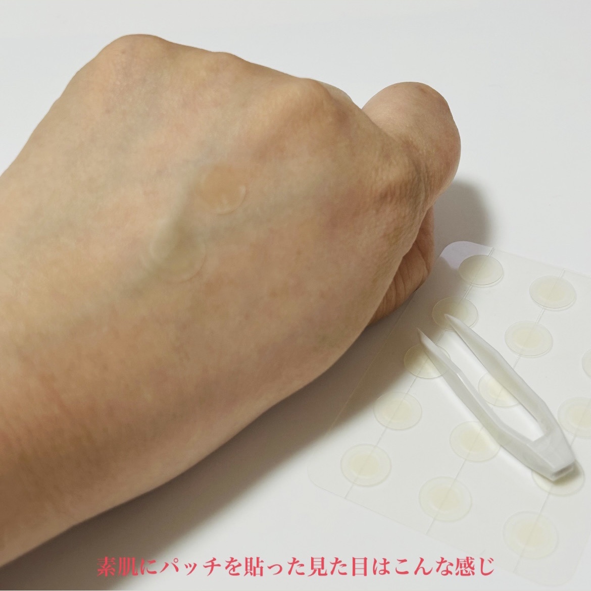 ビューティー スポットパッチ/イージーダムビューティー/にきびパッチを使ったクチコミ（3枚目）