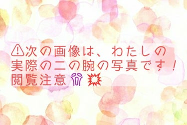 二の腕ザラザラを洗う重曹石けん/ペリカン石鹸/ボディ石鹸を使ったクチコミ（3枚目）